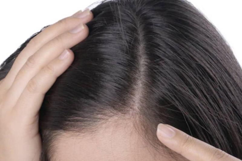 زيوت طبيعية لزيادة نمو وكثافة الشعر