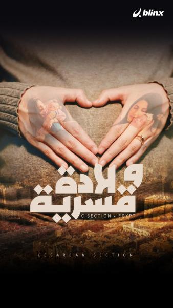 ولادة قسرية فيلم وثائقي يرصد احتلال مصر للمركز الأول عالميا في الولادة القيصرية